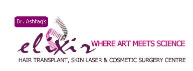 Elixir Hair Transplant Clinic Islamabad