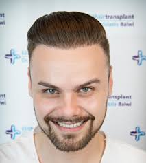 FUR Hair Transplant In Lahore